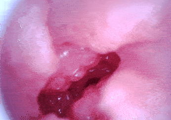 GXP-白丝三电动款测评，自带吮吸和震动功能的白丝！这下真的一滴不剩了