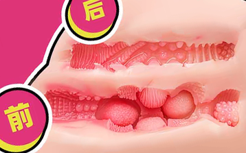 【群友投稿】ok—地雷系彼女测评，或许小臀硬的像雷，也算一种地雷系的表现（