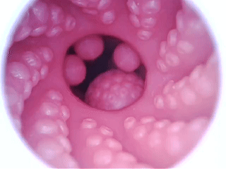 20260930165105691-动图.gif